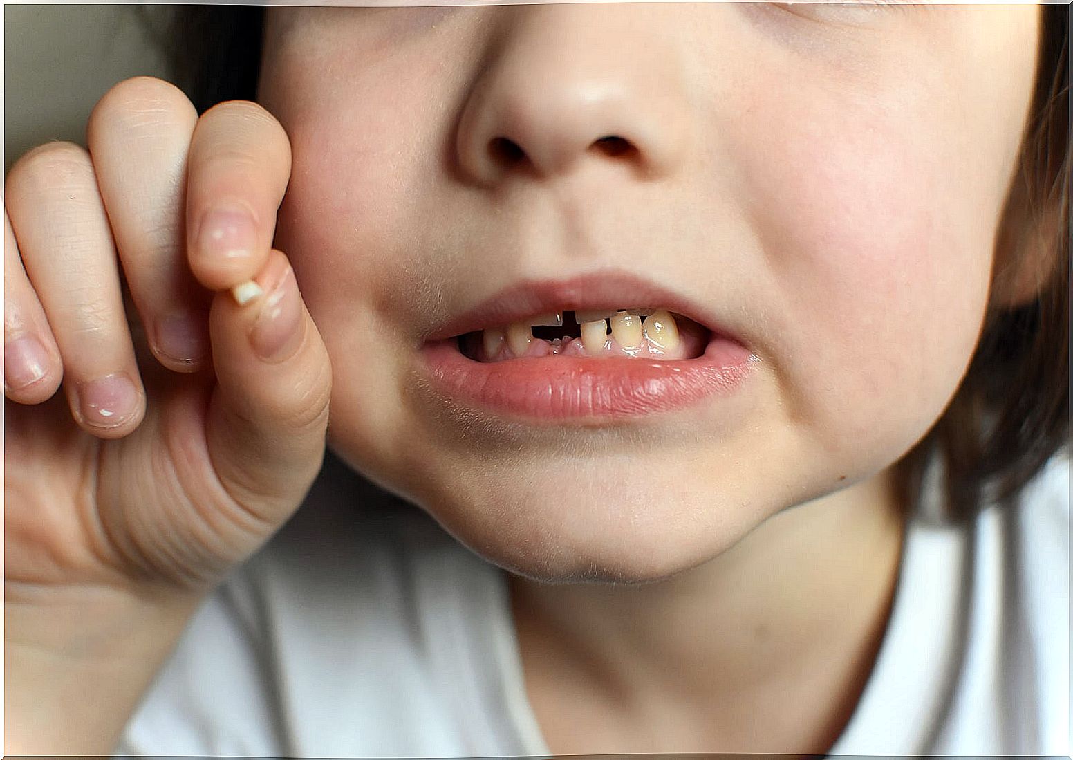 Bumps in milk teeth, what to do?