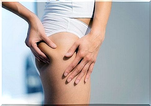 How to fight cellulite after pregnancy?