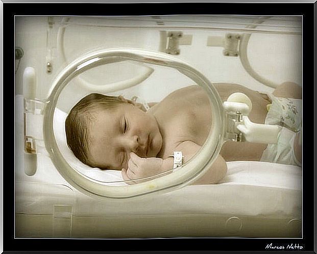 What special care does a premature baby need?