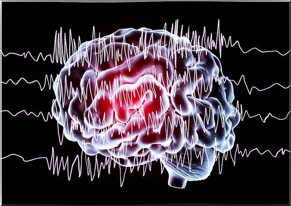 Non-epileptic paroxysmal episodes in children