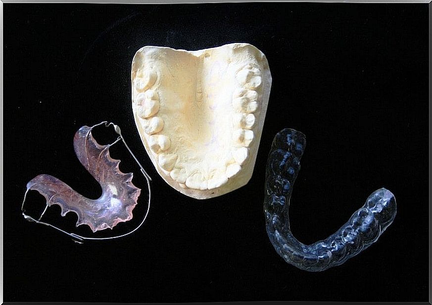 types-of-orthodontics